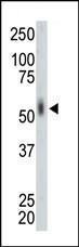 Anti-MKNK2 Rabbit Polyclonal Antibody (AP (Alkaline Phosphatase))