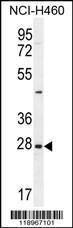 Anti-EDN3 Rabbit Polyclonal Antibody (AP (Alkaline Phosphatase))