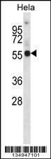 Anti-KCNA1 Rabbit Polyclonal Antibody (FITC (Fluorescein Isothiocyanate))