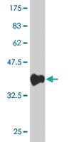 Anti-ZNF496 Mouse Monoclonal Antibody [clone: 4B1]