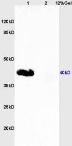 Anti-CD33 Rabbit Polyclonal Antibody