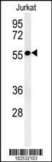 Anti-STK33 Rabbit Polyclonal Antibody (FITC (Fluorescein))