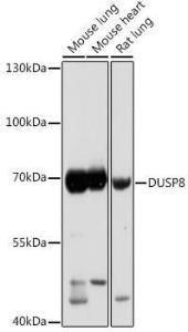 Anti-DUSP8 Rabbit Polyclonal Antibody