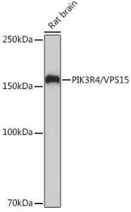 Anti-VPS15 antibody