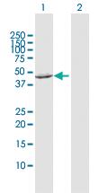 Anti-FBXO28 Rabbit Polyclonal Antibody