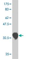 Anti-CSRP3 Mouse Monoclonal Antibody [clone: 6D2]