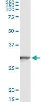 Anti-GSTT2 Antibody Pair