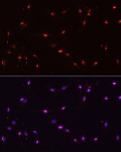 Antibody anti-ILF3 100 µl