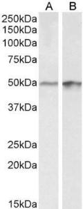 Anti-E2F4 Antibody (A85159) (0.3 µg/ml) staining of A43 (A) and HeLa (B) lysates (35 µg protein in RIPA buffer). Primary incubation was 1 hour. Detected by chemiluminescence