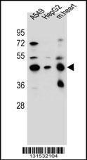 Anti-LRRC28 Rabbit Polyclonal Antibody (HRP (Horseradish Peroxidase))