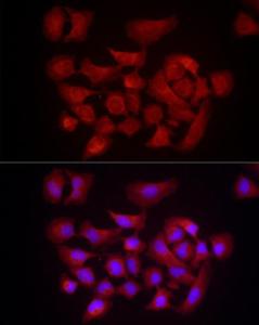 Anti-DUSP8 Rabbit Polyclonal Antibody