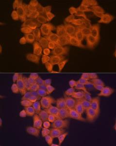 Anti-VPS15 antibody