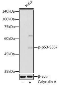 Anti-p53 (phospho Ser367) Rabbit Polyclonal Antibody