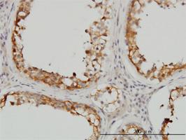 Anti-SDSL Mouse Monoclonal Antibody [clone: M2]