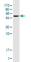 Anti-CD79B Mouse Monoclonal Antibody [clone: S2]