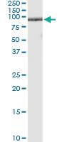 Anti-ZNF496 Polyclonal Antibody Pair