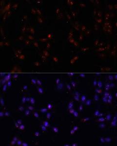 Antibody anti-ILF3 100 µl