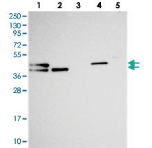 Anti-CHID1 Rabbit Polyclonal Antibody