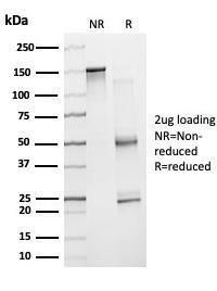 SDS-PAGE analysis of Anti-ZNF81 Antibody [PCRP-ZNF81-2C7] under non-reduced and reduced conditions; showing intact IgG and intact heavy and light chains, respectively. SDS-PAGE analysis confirms the integrity and purity of the antibody.