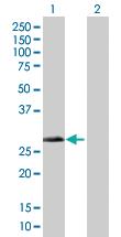 Anti-DHRS4 Mouse Polyclonal Antibody