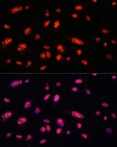 Antibody anti-ILF3 100 µl