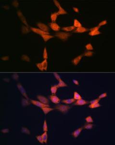 Anti-VPS15 antibody