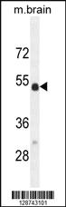 Anti-SLC16A11 Rabbit Polyclonal Antibody