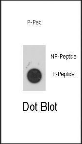 Anti-MAPKAPK2 Rabbit Polyclonal Antibody (AP (Alkaline Phosphatase))