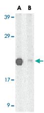 Anti-PERP Rabbit Polyclonal Antibody