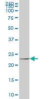 Anti-NOP16 Mouse Monoclonal Antibody [clone: 1G4]