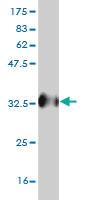 Anti-UBQLN2 Mouse Monoclonal Antibody [clone: 5F5]