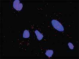 Anti-STK11 + STRADA Antibody Pair