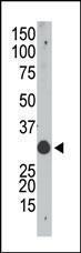 Anti-APOBEC1 Rabbit Polyclonal Antibody (AP (Alkaline Phosphatase))