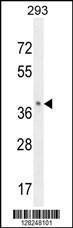 Anti-OR8B8 Rabbit Polyclonal Antibody (FITC (Fluorescein Isothiocyanate))