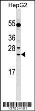 Anti-LRRC29 Rabbit Polyclonal Antibody (Biotin)