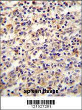 Anti-IGF2BP2 Rabbit Polyclonal Antibody