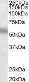 Anti-TFEB Antibody (A83495) (1 µg/ml) staining of Human Lung lysate (35 µg protein in RIPA buffer). Primary incubation was 1 hour. Detected by chemiluminescence