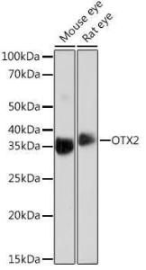 Anti-Otx2 antibody