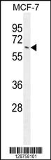 Anti-NKPD1 Rabbit Polyclonal Antibody