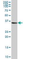 Anti-PURA Mouse Monoclonal Antibody [clone: 3A9]