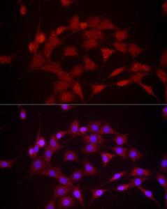 Anti-DUSP8 Rabbit Polyclonal Antibody