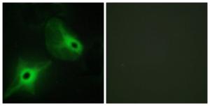 Immunofluorescence analysis of HeLa cells using Anti-KSR2 Antibody. The right hand panel represents a negative control, where the antibody was pre-incubated with the immunising peptide.