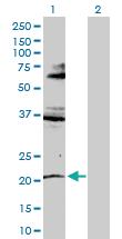 Anti-RNF135 Rabbit Polyclonal Antibody