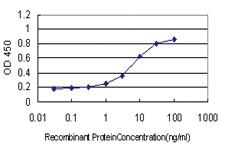 Anti-SDSL Mouse Monoclonal Antibody [clone: M2]