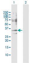 Anti-CASP7 Rabbit Polyclonal Antibody