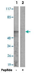 Anti-TCEB3C Rabbit Polyclonal Antibody