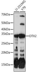 Anti-Otx2 antibody