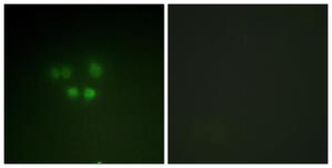 Immunofluorescence analysis of A549 cells using Anti-Nibrin Antibody. The right hand panel represents a negative control, where the antibody was pre-incubated with the immunising peptide