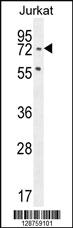 Anti-SLFN12L Rabbit Polyclonal Antibody