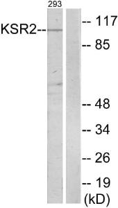 Western blot analysis of lysates from 293 cells using Anti-KSR2 Antibody. The right hand lane represents a negative control, where the antibody is blocked by the immunising peptide.